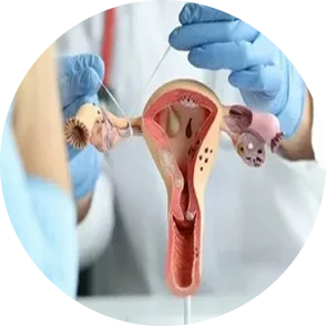 Endocrine disorders and gynecological diseases