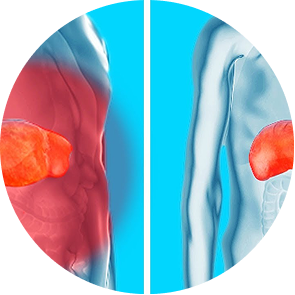 Poor liver and kidney function