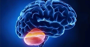 Cerebellar Ataxia