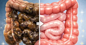 Liver Detox