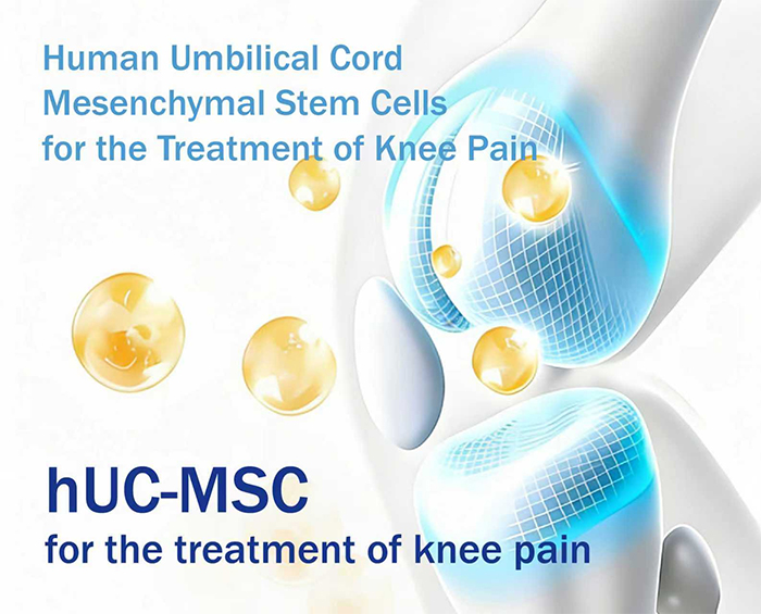 Stem Cell Therapy for Arthritis